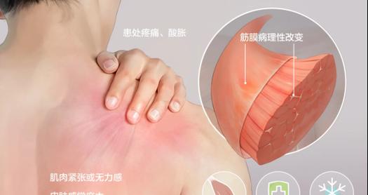 双鹿冰柜结霜问题如何处理？有效解决方法是什么？  第2张